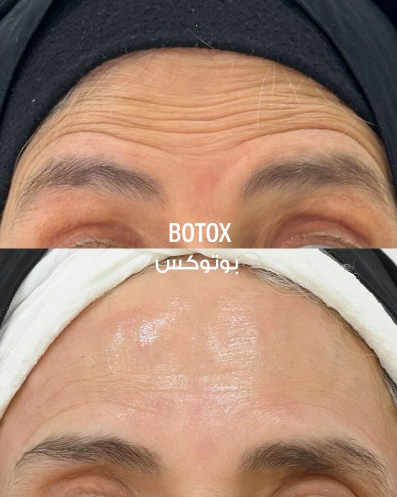 6ed8b6373827293effbf976f2108c4a6