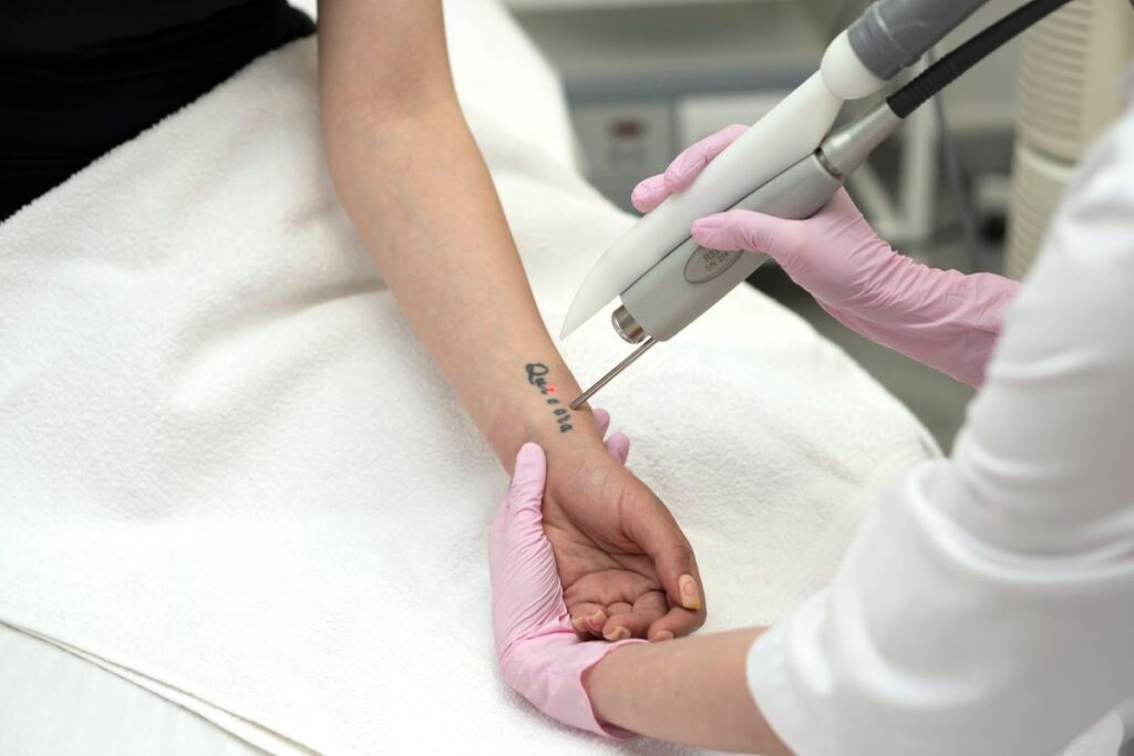 close up,of,a,doctor,doing,a,tattoo,removal,procedure,on