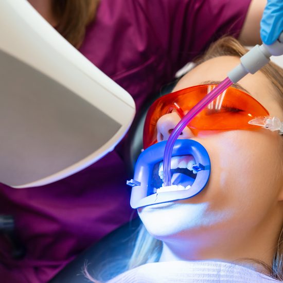 teeth whitening 550x550